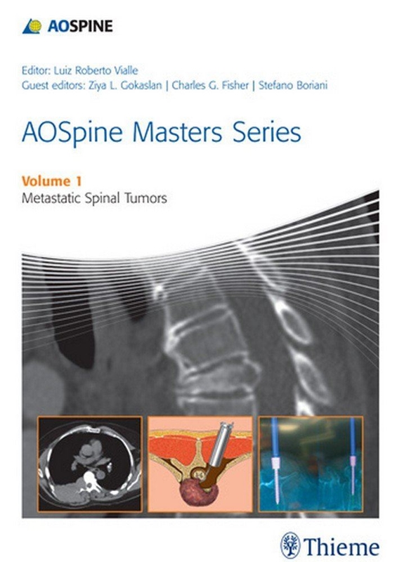 resm AOSpine Masters Series Volume 1