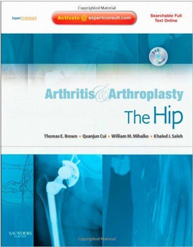 resm Arthritis and Arthroplasty: The Hip