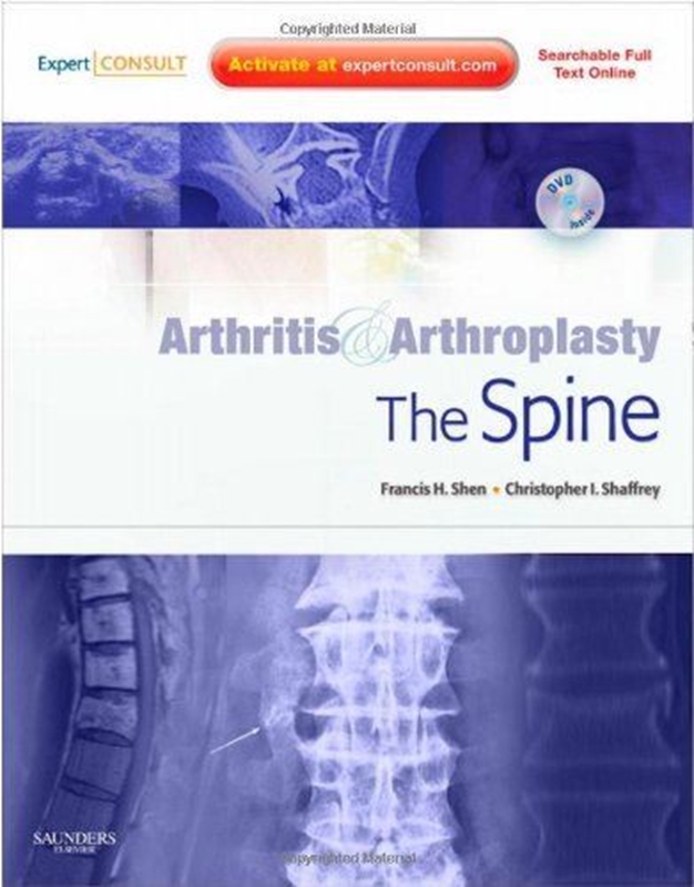 resm Arthritis and Arthroplasty: The Spine