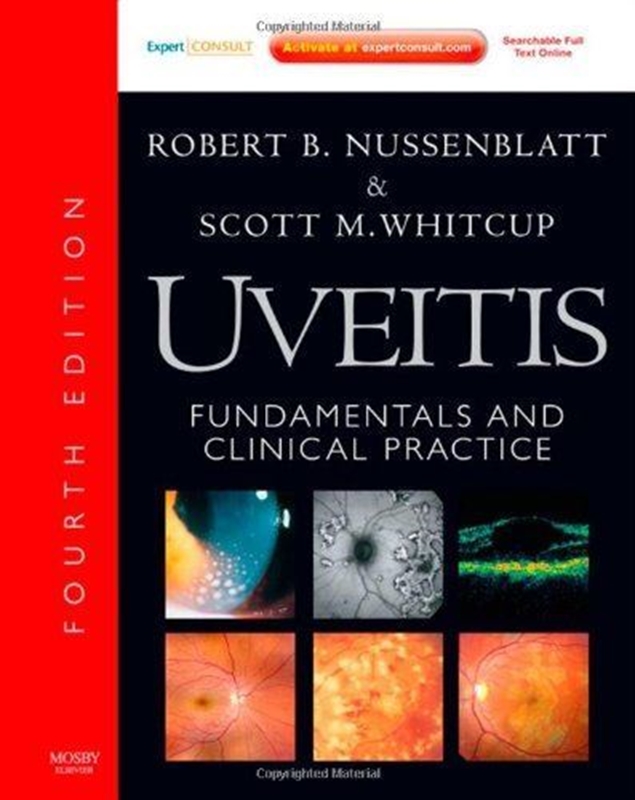 resm Uveitis: Fundamentals And Clinical Practice 4e