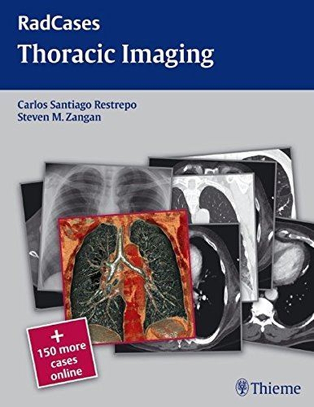 resm Radcases Thoracic Imaging