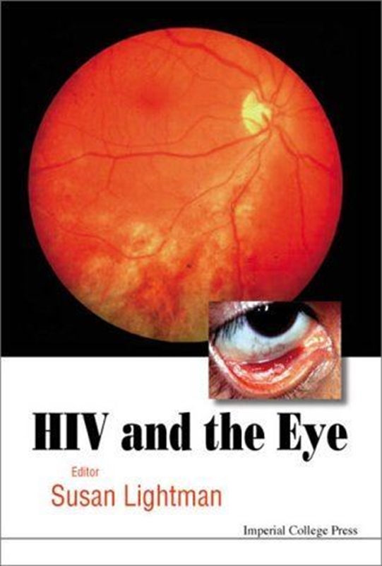 resm HIV And The Eye