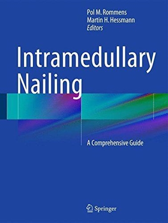 Resim Intramedullary Nailing