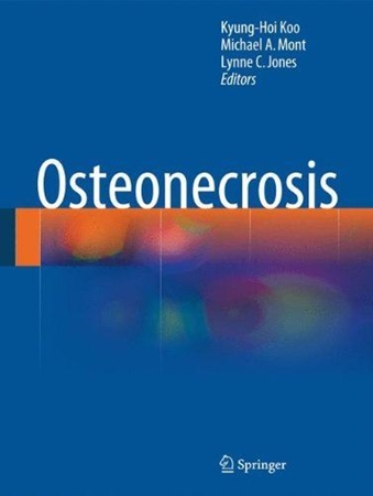 Resim Osteonecrosis