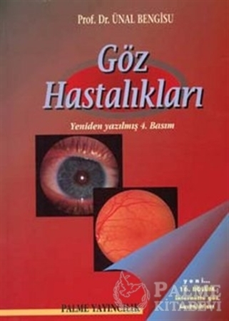 Resim Göz Hastalıkları