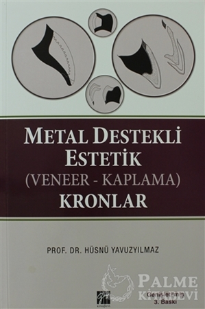Resim Metal Destekli Estetik (Veneer-Kaplama)Kronlar