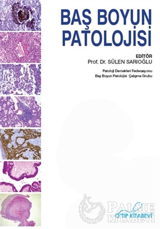 resm Baş Boyun Patolojisi