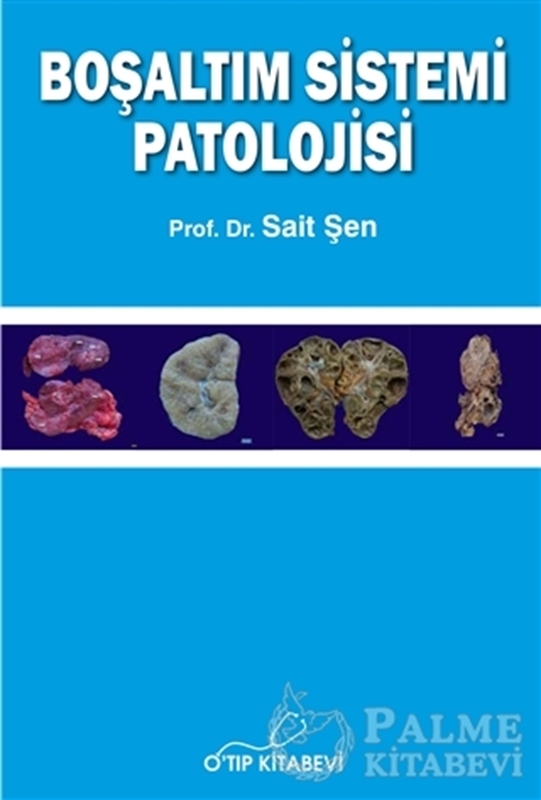 resm Boşaltım Sistemi Patolojisi