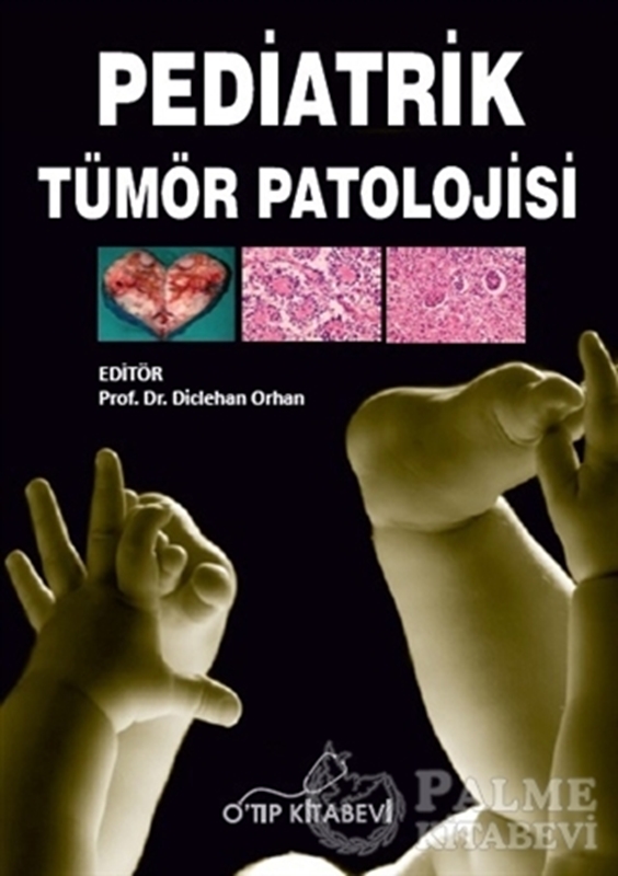 resm Pediatrik Tümör Patolojisi