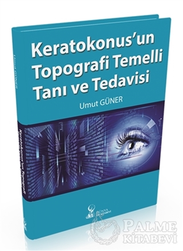 resm Keratokonus'un topografi temelli tanı ve tedavisi