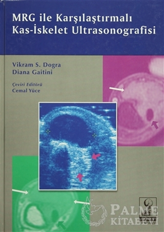 resm Mrg ile karşılaştırmalı kas-iskelet ultrasonografisi