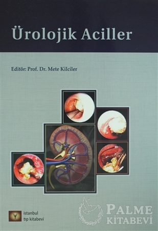 Resim Ürolojik Aciller