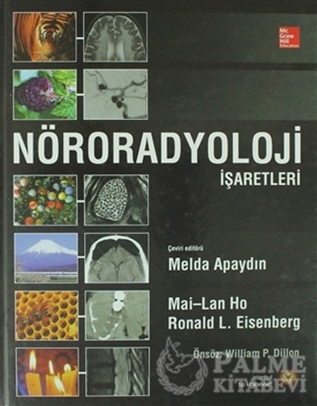 Resim Nöroradyoloji İşaretleri
