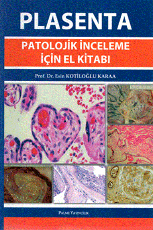 resm Plasenta Patolojik İnceleme İçin El Kitabı