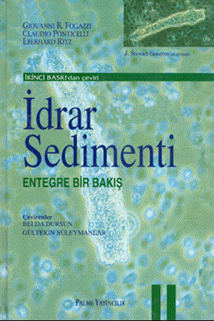 Resim İdrar Sedimenti