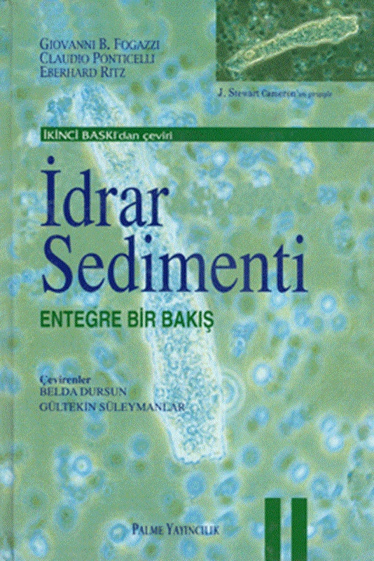 resm İdrar Sedimenti