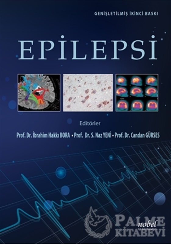 resm Epilepsi