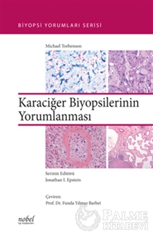 resm Karaciğer Biyopsilerinin Yorumlanması