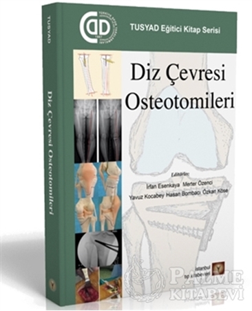 Resim Diz Çevresi Osteotomileri
