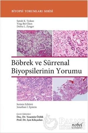Resim Böbrek ve Sürrenal Biyopsilerinin Yorumu