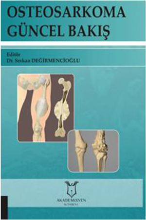 Resim Osteosarkoma Güncel Bakış
