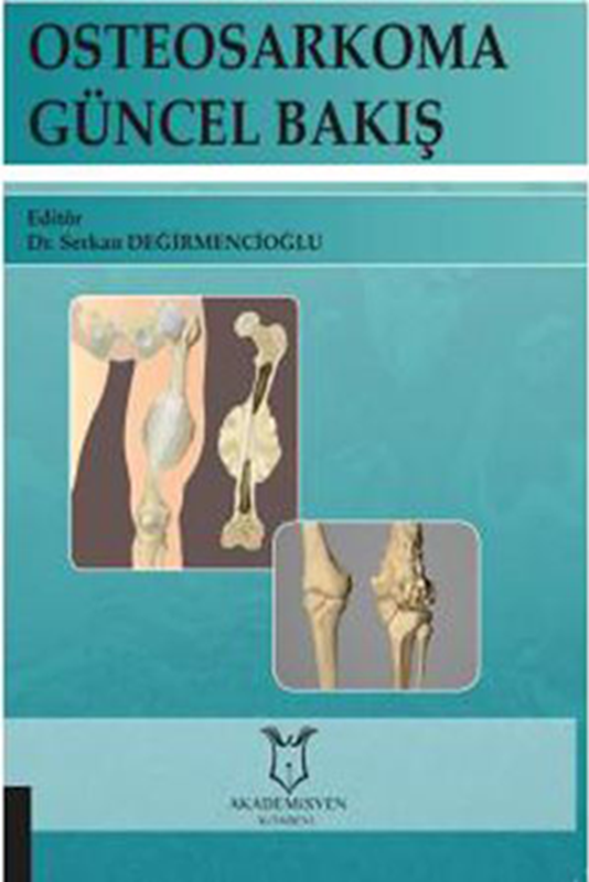 resm Osteosarkoma Güncel Bakış