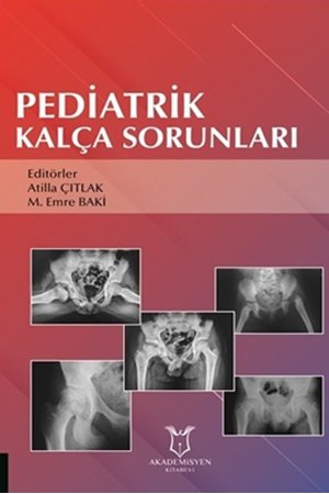 Resim Pediatrik Kalça Sorunları