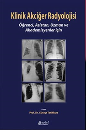 Resim Klinik Akciğer Radyolojisi