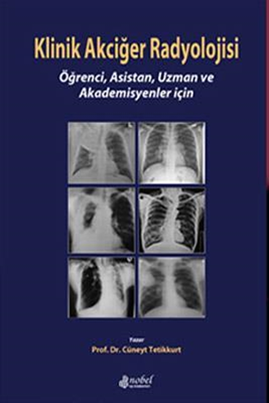 resm Klinik Akciğer Radyolojisi