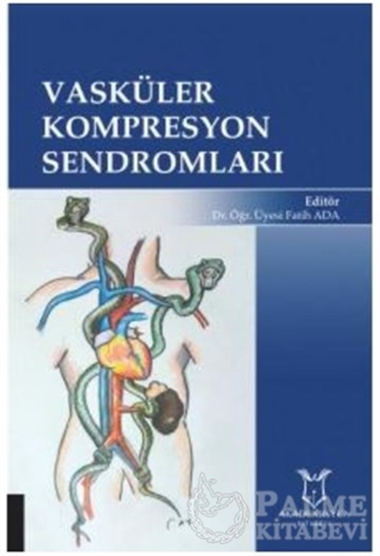 resm Vasküler Kompresyon Sendromları