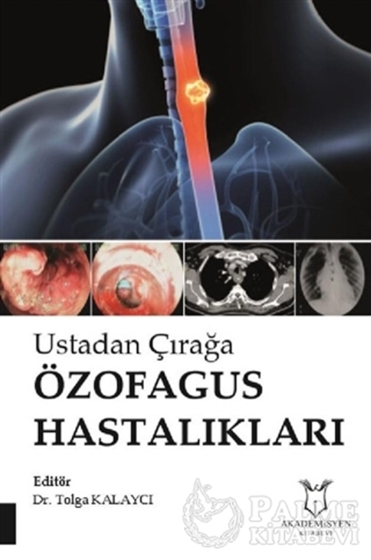 resm Ustadan Çırağa Özofagus Hastalıkları