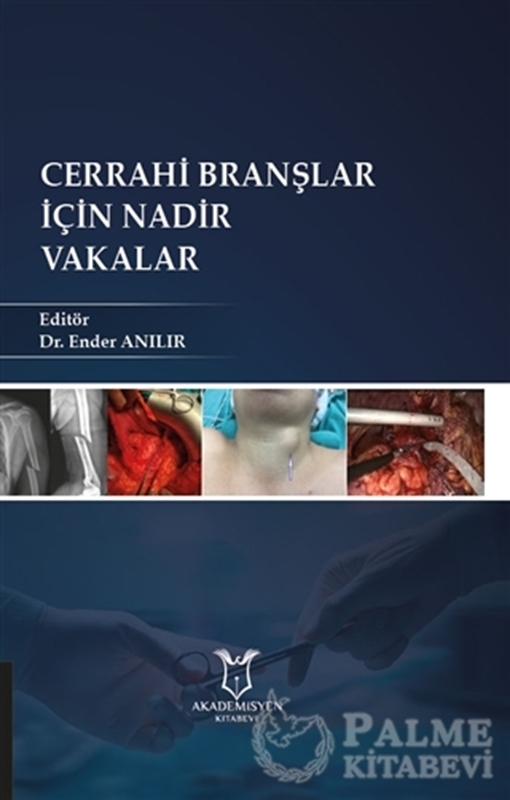 resm Cerrahi Branşlar İçin Nadir Vakalar
