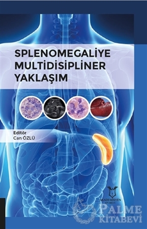 Resim Splenomegaliye Multidisipliner Yaklaşım
