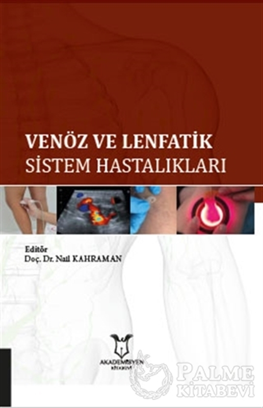resm Venöz ve Lenfatik Sistem Hastalıkları