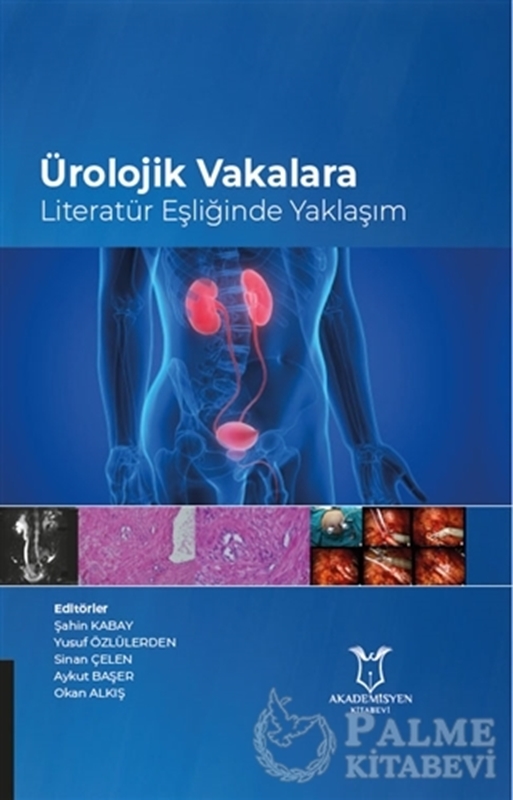 resm Ürolojik Vakalara Literatür Eşliğinde Yaklaşım
