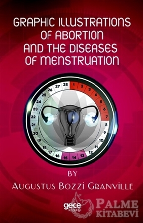Resim Graphic Illustrations Of Abortion And The Diseases Of Menstruation