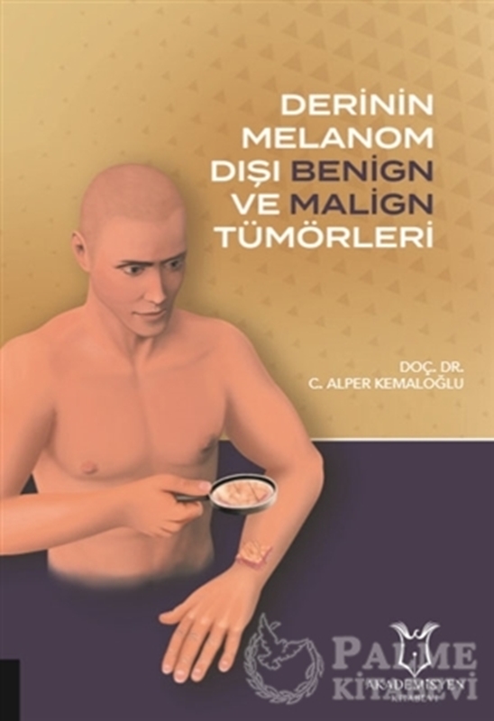 resm Derinin Melanom Dışı Benign ve Malign Tümörleri