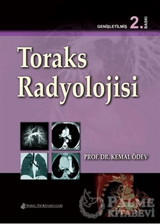 Resim Toraks Radyolojisi