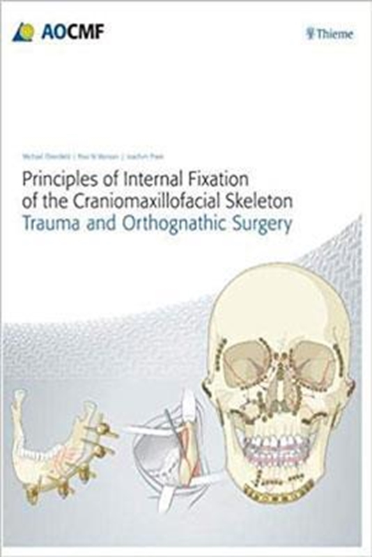resm Principles of Internal Fixation of the Craniomaxillofacial Skeleton