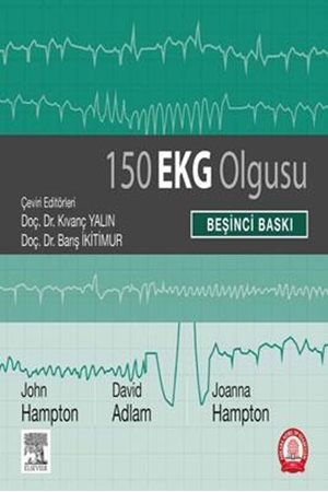 Resim 150 EKG Problemleri