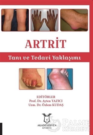 Resim ARTRİT - Tanı ve Tedavi Yaklaşımı