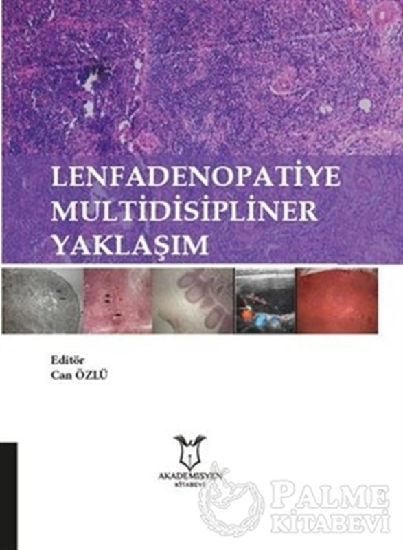 resm Lenfadenopatiye Multidisipliner Yaklaşım