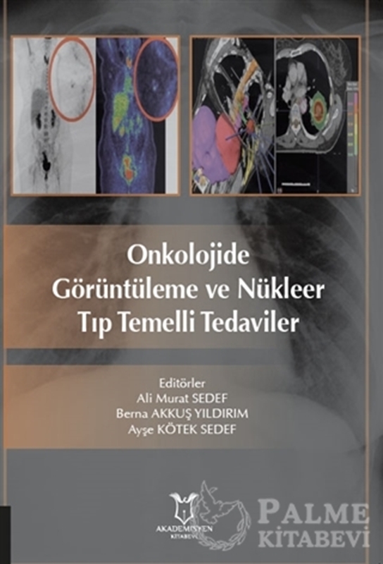 resm Onkolojide Görüntüleme ve Nükleer Tıp Temelli Tedaviler