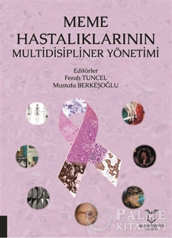 resm Meme Hastalıklarının Multidisipliner Yönetimi