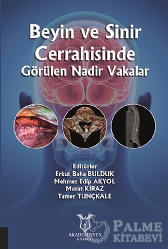 resm Beyin ve Sinir Cerrahisinde Görülen Nadir Vakalar