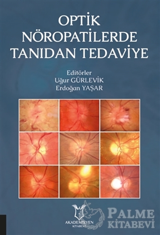 resm Optik Nöropatilerde Tanıdan Tedaviye