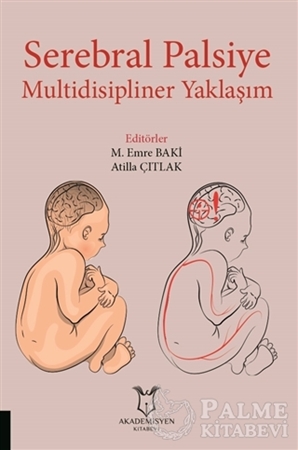 Resim Serebral Palsiye Multidisipliner Yaklaşım
