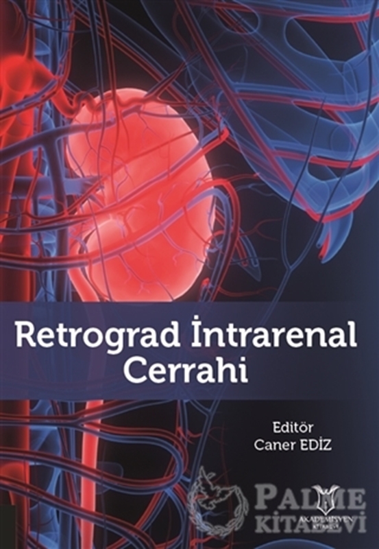 resm Retrograd İntrarenal Cerrahi