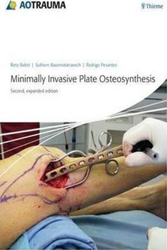 resm Minimally Invasive Plate Ostheosynthesis