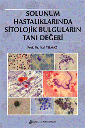 Resim Solunum Hastalıklarında Sitolojik Bulguların Tanı Değeri
